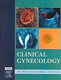 Clinical Gynecology (Hardcover, 1st)
