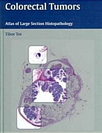 Colorectal Tumors: Atlas of Large Section Histopathology (Hardcover)