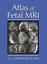 Atlas Of Fetal MRI (Hardcover)