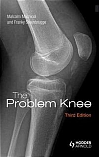The Problem Knee (Hardcover, 3 ed)