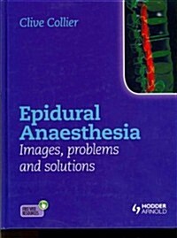 Epidural Anaesthesia: Images, Problems and Solutions (Hardcover)