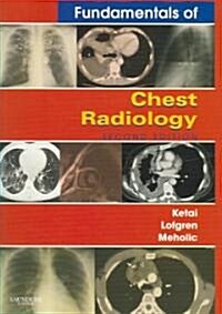 Fundamentals of Chest Radiology (Paperback, 2nd)