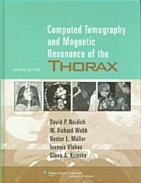 Computed Tomography and Magnetic Resonance of the Thorax (Hardcover, 4)