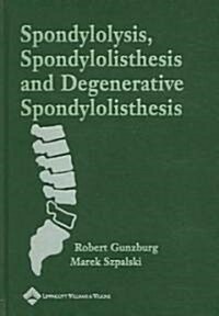 Spondylosis, Spondylolisthesis, And Degenerative Spondylolisthesis (Hardcover)