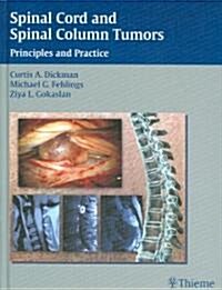 Spinal Cord and Spinal Column Tumors: Principles and Practice (Hardcover)