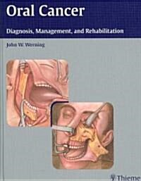 Oral Cancer: Diagnosis, Management, and Rehabilitation (Hardcover)