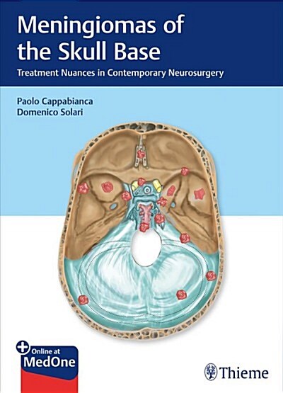 Meningiomas of the Skull Base: Treatment Nuances in Contemporary Neurosurgery (Hardcover)