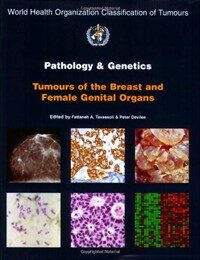 Pathology and genetics of tumours of the breast and female genital organs