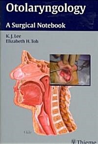 Otolaryngology: A Surgical Notebook (Paperback)