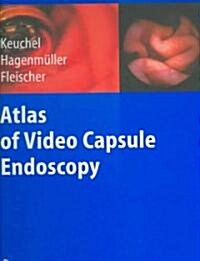 Atlas of Video Capsule Endoscopy (Hardcover)