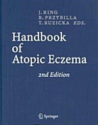 Handbook of Atopic Eczema (Hardcover, 2nd)