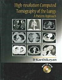 High-resolution Computed Tomography of the Lungs (Hardcover, CD-ROM)