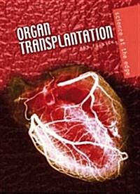Organ Transplantation (Paperback)
