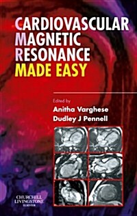 Cardiovascular Magnetic Resonance Made Easy (Paperback)