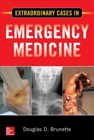 [중고] Extraordinary Cases in Emergency Medicine (Paperback)