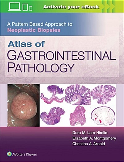 Atlas of Gastrointestinal Pathology: A Pattern Based Approach to Neoplastic Biopsies (Hardcover)