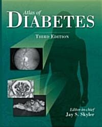 Atlas of Diabetes (Hardcover, 3rd)