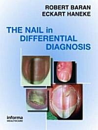Nail in Differential Diagnosis (Hardcover)