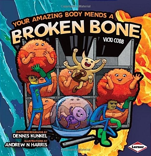 Your Amazing Body Mends a Broken Bone (Paperback)