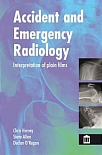 Accident and Emergency Radiology : X Ray Interpretation (Paperback)