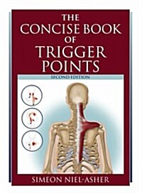 Concise Book of Trigger Points (Paperback)