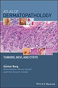 Atlas of Dermatopathology: Tumors, Nevi, and Cysts (Hardcover)