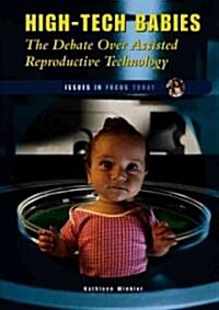 High-Tech Babies: The Debate Over Assisted Reproductive Technology (Library Binding)