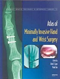 Atlas of Minimally Invasive Hand and Wrist Surgery (Hardcover)