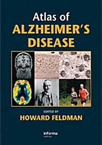Atlas of Alzheimers Disease (Hardcover)