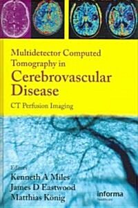 Multidetector Computed Tomography in Cerebrovascular Disease : CT Perfusion Imaging (Hardcover)
