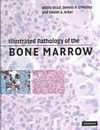 Illustrated Pathology of the Bone Marrow (Hardcover)