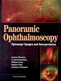 Panoramic Ophthalmoscopy: Optomap Images and Interpretation (Hardcover)