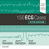 150 ECG Cases (Paperback, 5 ed)