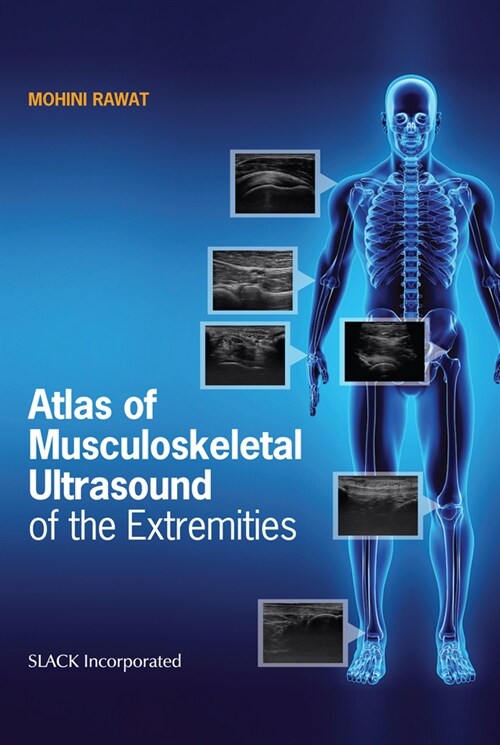 Atlas of Musculoskeletal Ultrasound of the Extremities (Paperback)