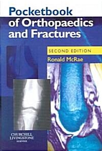 Pocketbook of Orthopaedics and Fractures (Paperback, 2 Rev ed)