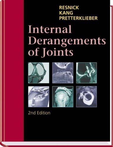Internal Derangements of Joints (Hardcover, 2 Rev ed)