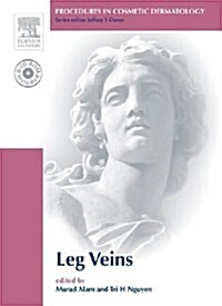 [중고] Treatment of Leg Veins (Hardcover, DVD-ROM)
