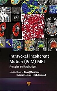Intravoxel Incoherent Motion (IVIM) MRI: Principles and Applications (Hardcover)