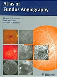 Atlas of Fundus Angiography (Hardcover, 1st)