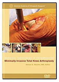 Minimal Invasive Total Knee Arthroplasty (DVD)