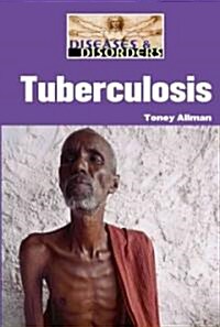 Tuberculosis (Library Binding)