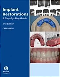 Implant Restorations: A Step-By-Step Guide (Hardcover, 2nd)
