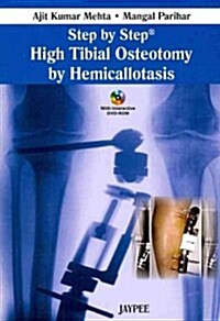 Step by Step High Tibial Osteotomy by Hemicallotasis (Paperback, 1st, Mini)