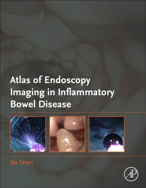 Atlas of Endoscopy Imaging in Inflammatory Bowel Disease (Hardcover)