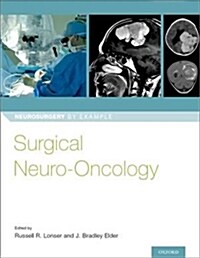 Surgical Neuro-Oncology (Paperback)