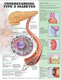 Understanding Type 2 Diabetes Chart (Paperback, 2nd)