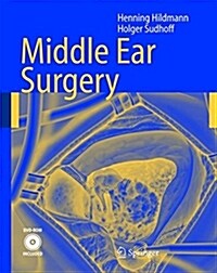 Middle Ear Surgery [With DVD] (Hardcover)