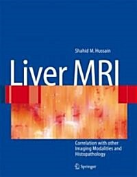 Liver MRI (Hardcover, 1st)