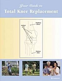 Your Guide to Total Knee Replacement (Paperback, Spiral)