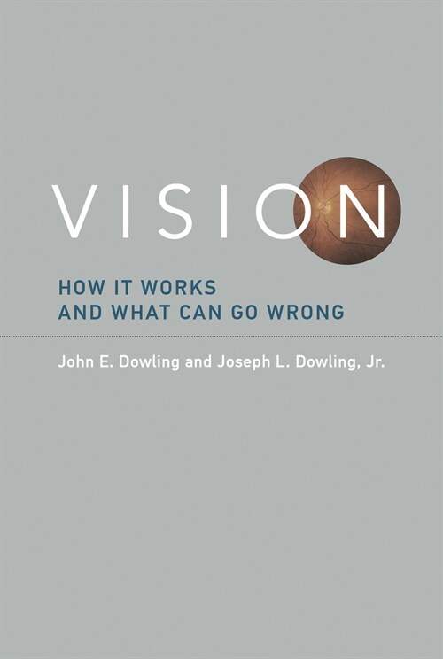Vision: How It Works and What Can Go Wrong (Paperback)